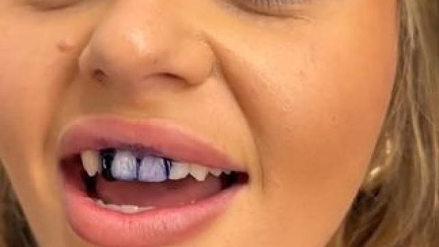 30秒拯救大黄牙！牙齿也有素颜霜了！调色原理逆袭大黄牙！非永久性的哦！#牙膏推荐 #牙齿美白 #牙黄