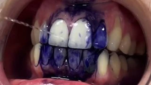 牙齿也有素颜霜了，产品的原理就是黄色和紫色中和变成白色，非永久性的哦  #牙齿美白 #hismile