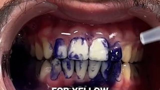 30秒拯救大黄牙！牙齿也有素颜霜了！调色原理逆袭大黄牙！非永久性的哦！#牙膏推荐 #牙齿美白 #牙黄