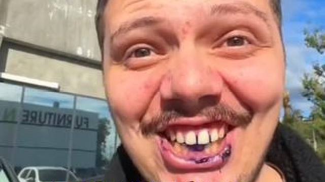 30秒拯救大黄牙！牙齿也有素颜霜了！调色原理逆袭大黄牙！非永久性的哦！#牙膏推荐 #牙齿美白 #牙黄