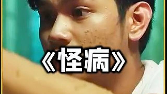 男人的怪病太倒灶了，惊悚影片 男人的怪病太倒灶了，惊悚影片