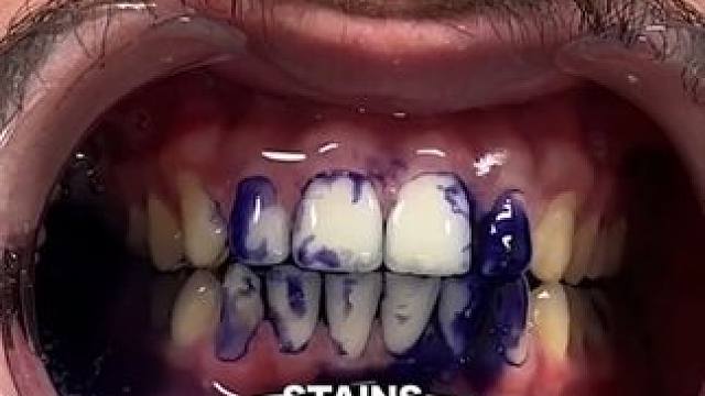 30秒拯救大黄牙！牙齿也有素颜霜了！调色原理逆袭大黄牙！非永久性的哦！#牙膏推荐 #牙齿美白 #牙黄