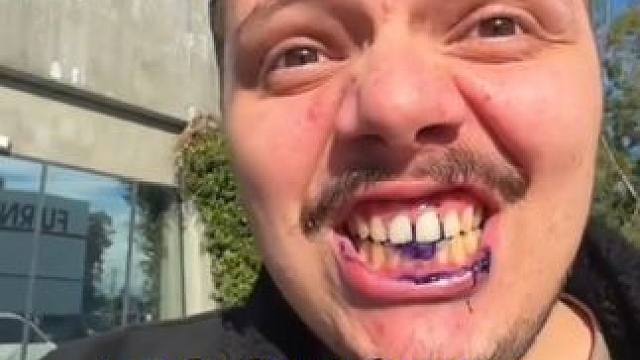 30秒拯救大黄牙！牙齿也有素颜霜了！调色原理逆袭大黄牙！非永久性的哦！#牙膏推荐 #牙齿美白 #牙黄