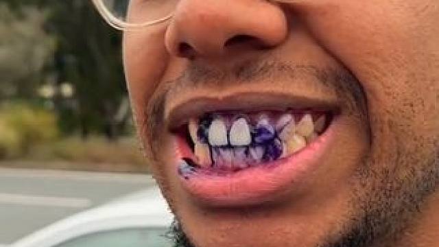 牙齿也有素颜霜了，产品的原理就是黄色和紫色中和变成白色，非永久性的哦  #牙齿美白 #hismile