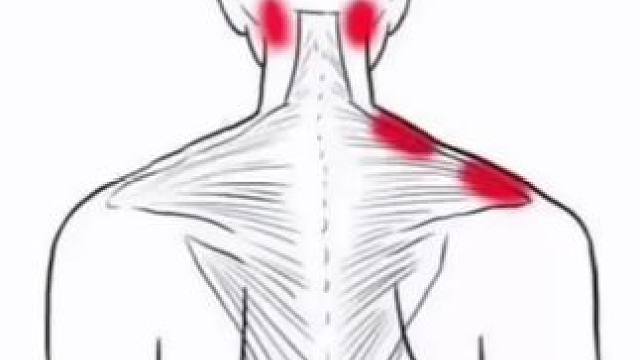 #哪里不舒服拉哪里