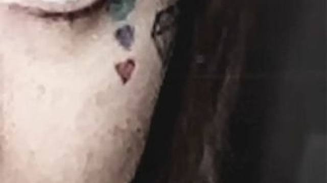 无处不在的霉菌让她痛苦难耐 #娱乐评论大赏 #怪病 #纪录片