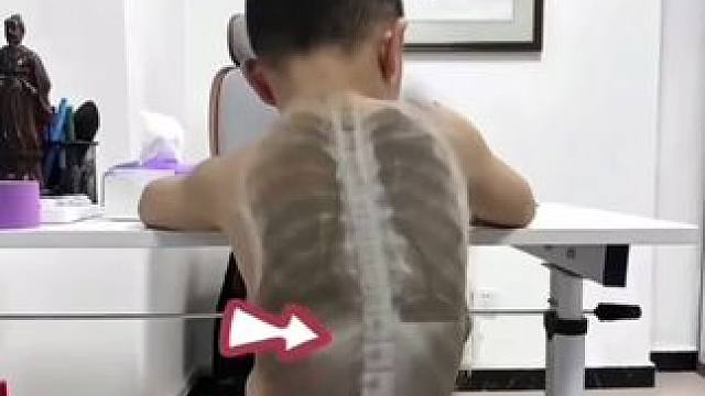 孩子圆肩 驼背，你一定要让他每天睡前躺一会，坚持下来，你会发现孩子#驼背改善了#背挺了 看着也想显高