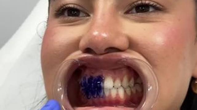 30秒拯救大黄牙！牙齿也有素颜霜了！调色原理逆袭大黄牙！非永久性的哦！#牙膏推荐 #牙齿美白 #牙黄