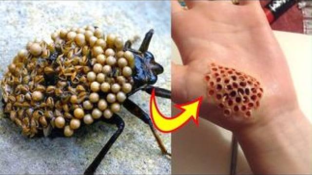 世界上最危险的10种昆虫（2） #知识科普 #寄生虫 #涨见识 #大自然的生存法则 #昆虫