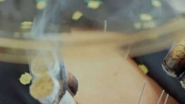 国医大师给国医少年团科普艾灸知识，大家听的很认真。