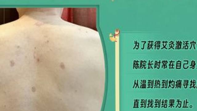 老中医早年在做艾灸研究的时候，都在自己身上是做试验，为此全身留下了很多疤痕。