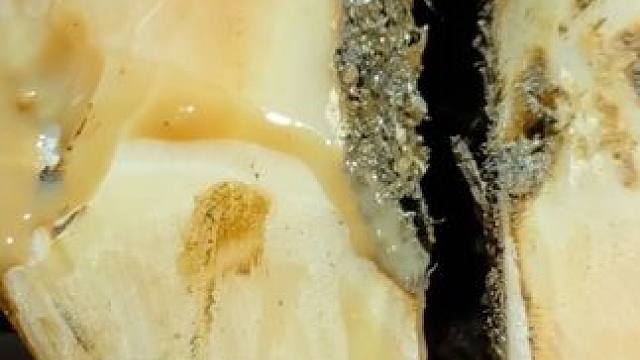 一个不起眼的缺陷竟让小哥发现了牛汁，不要紧这次有后续复查#解压#修牛蹄