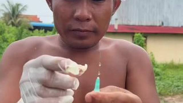 小宝贝医生来了 #东南亚矮子 #东南亚八面佛 #东南亚美食 #看一遍笑一遍 #泰国美食