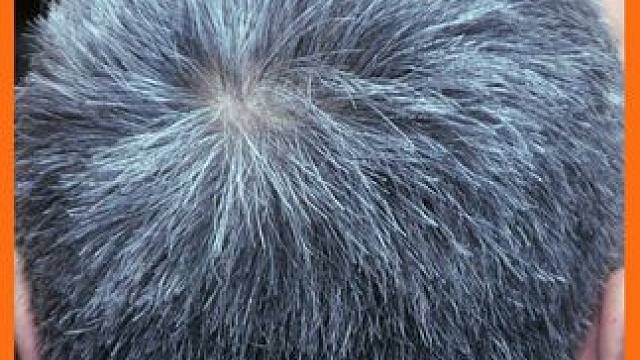 #男人身体 #白发 #满格状态