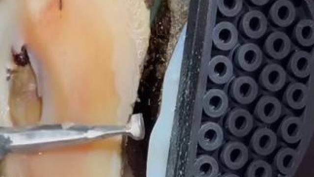 大半个蹄底都分离的牛牛，走路竟然毫无异样#解压#修牛蹄