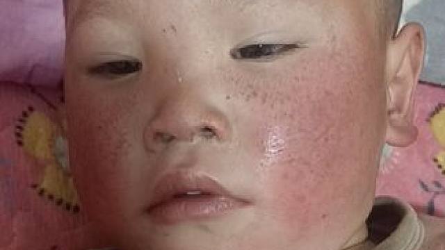 每天一到夜深就发烧，不知道是不是闯到什了。#记录生活