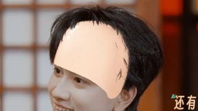 #国医少年志  注意！发际线上移要重视，针药配合可以缓解脱发。