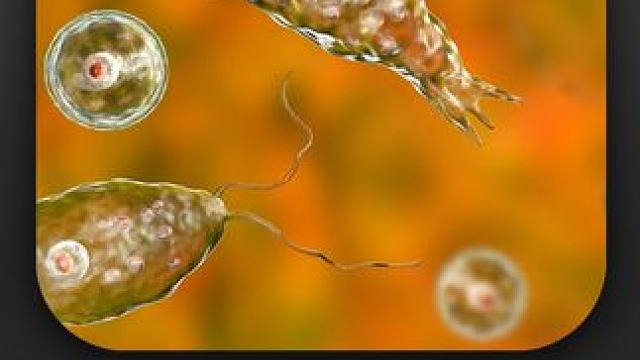 这是寄生虫啃食大脑的真实画面
这些微小的虫子，虽然体积只有二十微米，致死率高达97%，这种专吃大脑的