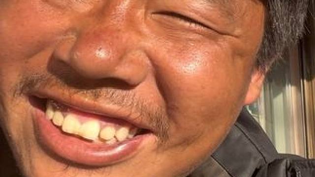 有没有搞错，肿的像猪头一样了 #记录真实生活 #我的骑行日常 #真实户外 #旅行 #刘不韦