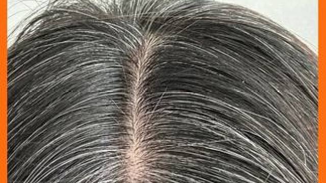 #女人白头发 #维生素