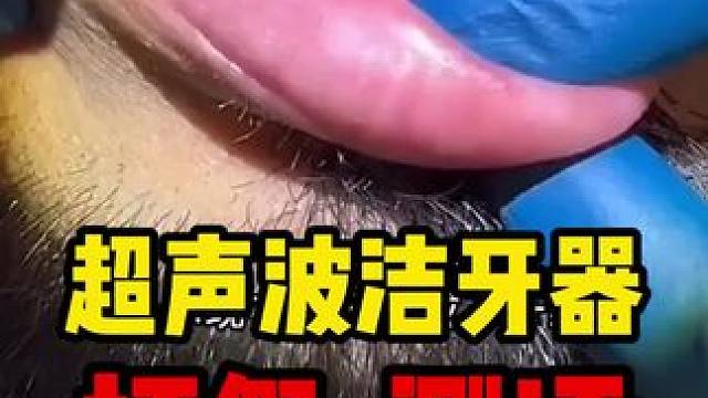 这个超声波洁牙器确实好用啊~平时对自己牙齿不满意的直接安排上~#真实测评 #洁牙器超声波 #洁牙器