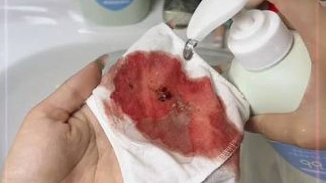 女孩子还是要对自己好一点，内裤还是得用内衣裤专用液，还是袋鼠妈妈母婴大品牌，买一瓶都够用大半年了!#