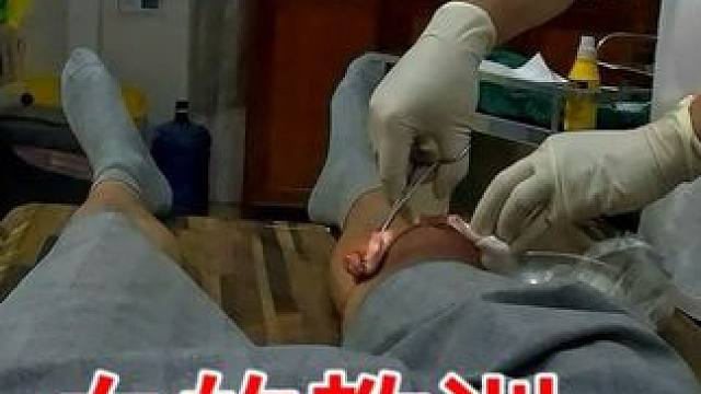 摩旅老挝意外受伤，被当地货车司机救了，凌晨送到医院缝了四针 #刘伟元的旅行 #东南亚