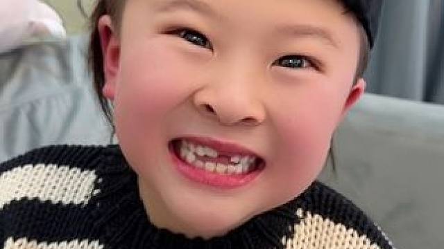 修补我的大门牙#妈咪新风向 #我家带娃有绝招 #修补我的大门牙