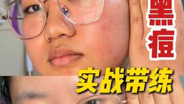 第二代欧诗漫安心小白管~