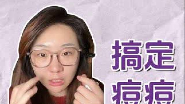 只要你成片长痘+红肿爆痘+反复长 我都帮你搞定 #护肤 #祛痘 #祛痘精华 #可复美秩序次抛 #痘印