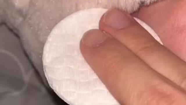 当你妻子会打鼾时，你该怎么办？#外置磁吸鼻腔扩张器