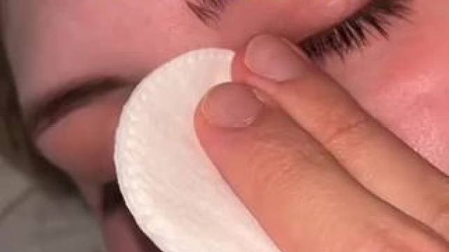 你妻子会打鼾，你会怎么办？#外置磁吸鼻腔扩大器