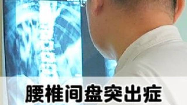 #腰椎 #腰椎间盘突出 #腰疼腿疼 #健康科普 #骨科专家尹辛成