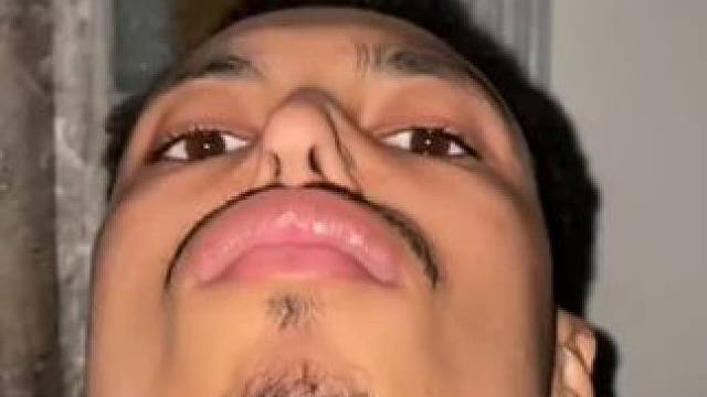 #止鼾器 #止鼾  #睡觉打呼噜 #睡觉打鼾