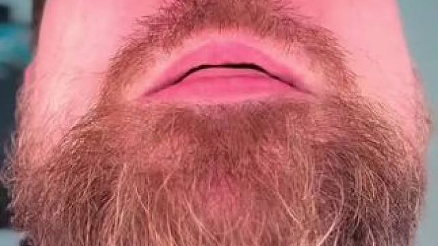 #止鼾 #止鼾器 #睡觉打呼噜 #睡觉打鼾