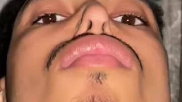 #止鼾 #止鼾器 #睡觉打呼噜 #睡觉打鼾