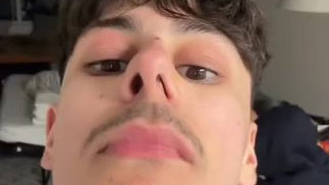 #止鼾 #止鼾器 #睡觉打呼噜 #睡觉打鼾