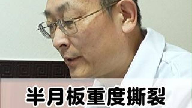 半月板重度撕裂必须手术吗？ #医学科普 #膝盖疼痛 #半月板撕裂 #手术 #骨科专家尹辛成