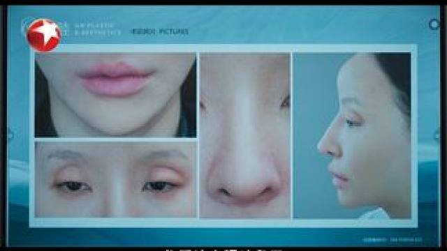 患者段萌萌来到格睦医院，她整形过度还想继续，实则是整形维权红人，全院医生反对周静雯为其手术。#东方卫