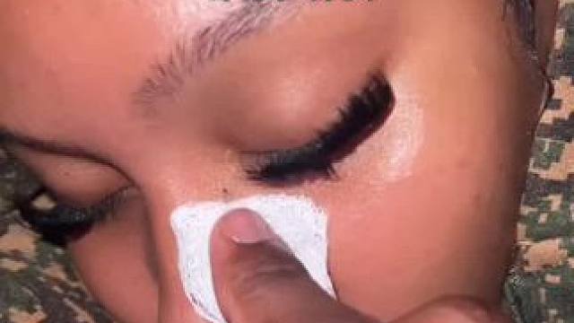 #止鼾 #止鼾器 #睡觉打呼噜 #睡觉打鼾