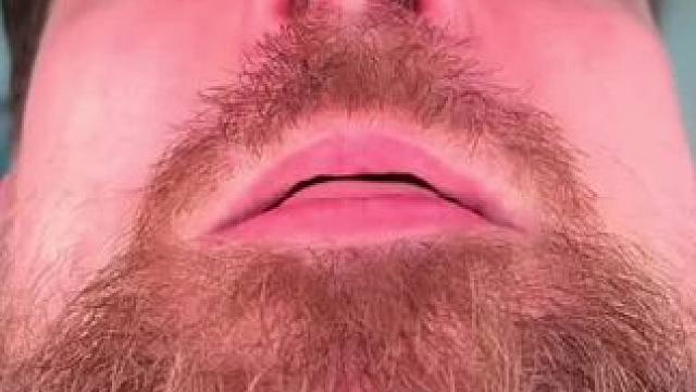 #止鼾 #止鼾器 #睡觉打呼噜 #睡觉打鼾