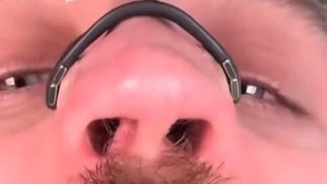 #止鼾 #止鼾器 #睡觉打呼噜 #睡觉打鼾