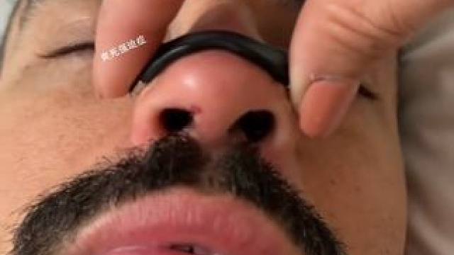 #止鼾 #止鼾器 #睡觉打呼噜 #睡觉打鼾