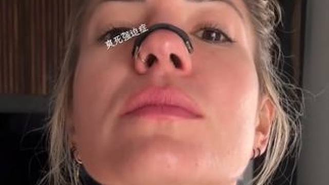 #止鼾 #止鼾器 #睡觉打呼噜 #睡觉打鼾