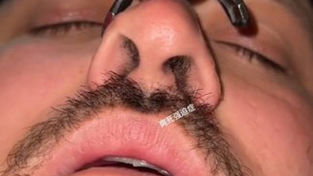 #止鼾 #止鼾器 #睡觉打呼噜 #睡觉打鼾#鼻塞怎么办