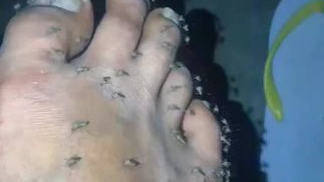 夏天蚊子来了，快来试试这款日本叮叮驱蚊液吧！