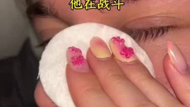 #止鼾 #止鼾器 #睡觉打呼噜 #睡觉打鼾