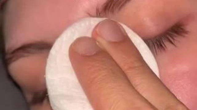 #止鼾 #止鼾器 #睡觉打呼噜 #睡觉打鼾