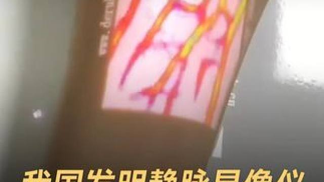 我国发明静脉显像仪，精准找到血管扎针 #中国  #黑科技  #静脉显像仪  #科技强国  #中国科技