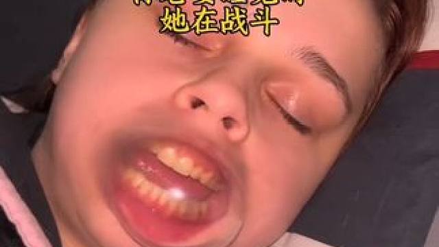 #止鼾 #止鼾器 #睡觉打呼噜 #睡觉打鼾